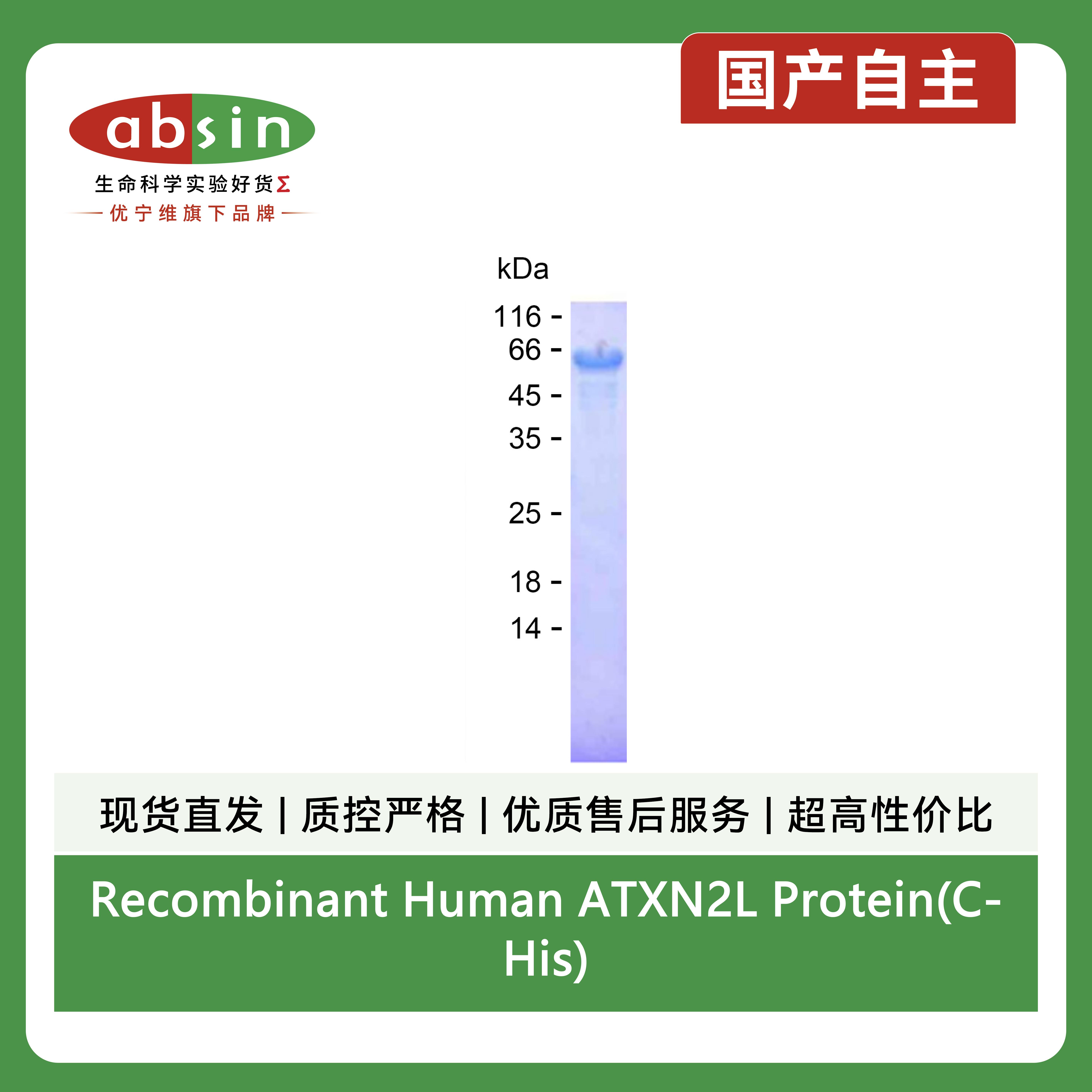 Recombinant Human ATXN2L Protein(C-His)产品图