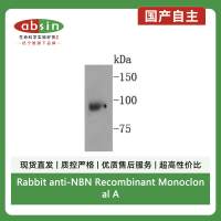 Rabbit anti-NBN Recombinant Monoclonal Antibody