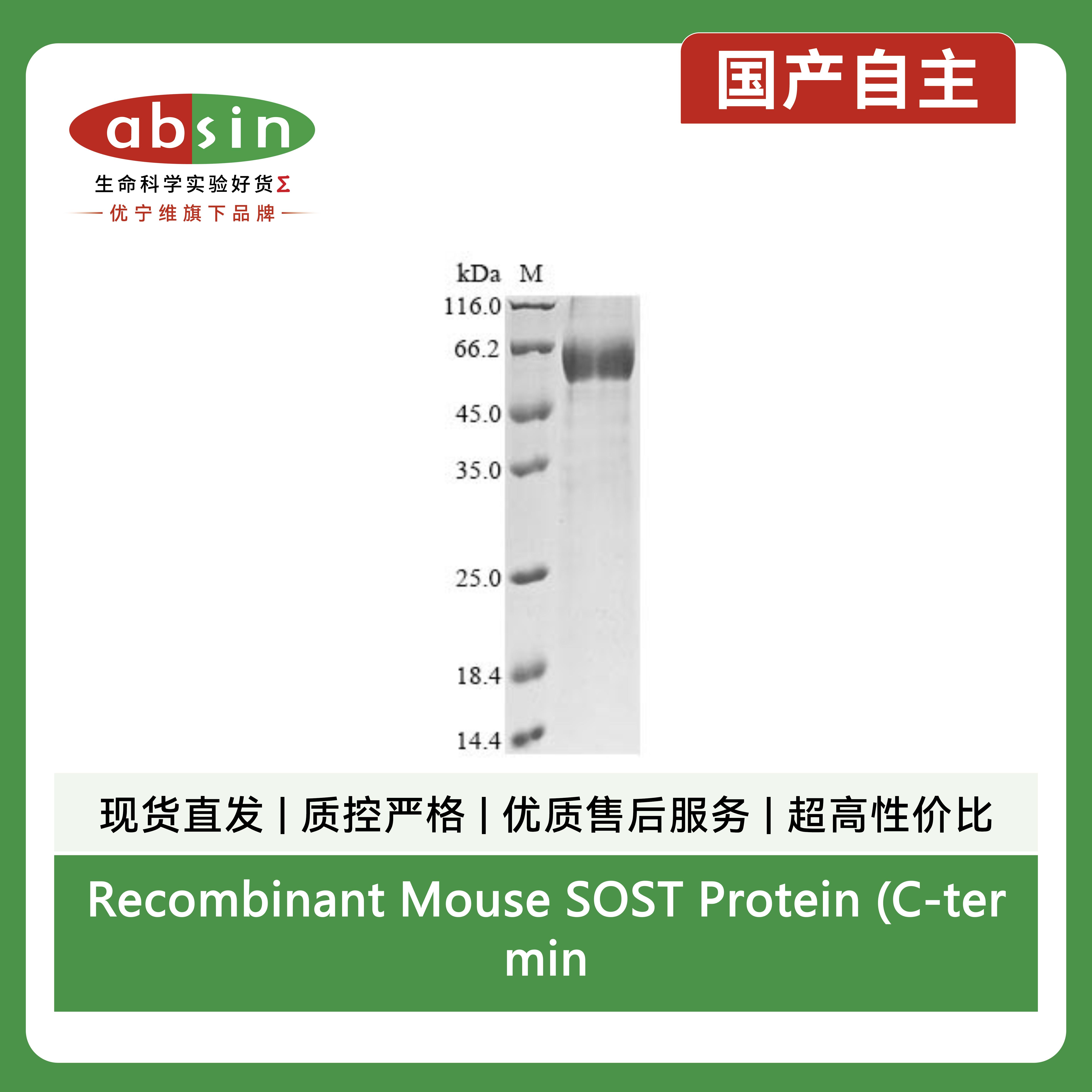 Recombinant Mouse SOST Protein (C-terminal hFc)产品图