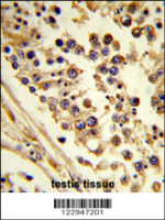 Rabbit anti-CNOT4 Polyclonal Antibody