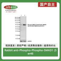 Rabbit anti-Phospho-Phospho-SMAD1 (Ser463/465)/ SMAD5 (Ser463/465)/ SMAD9 (Ser465/467) Monoclonal Antibody(S-3412)