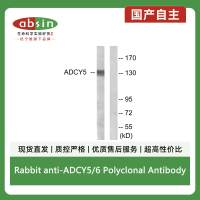 Rabbit anti-ADCY5/6 Polyclonal Antibody