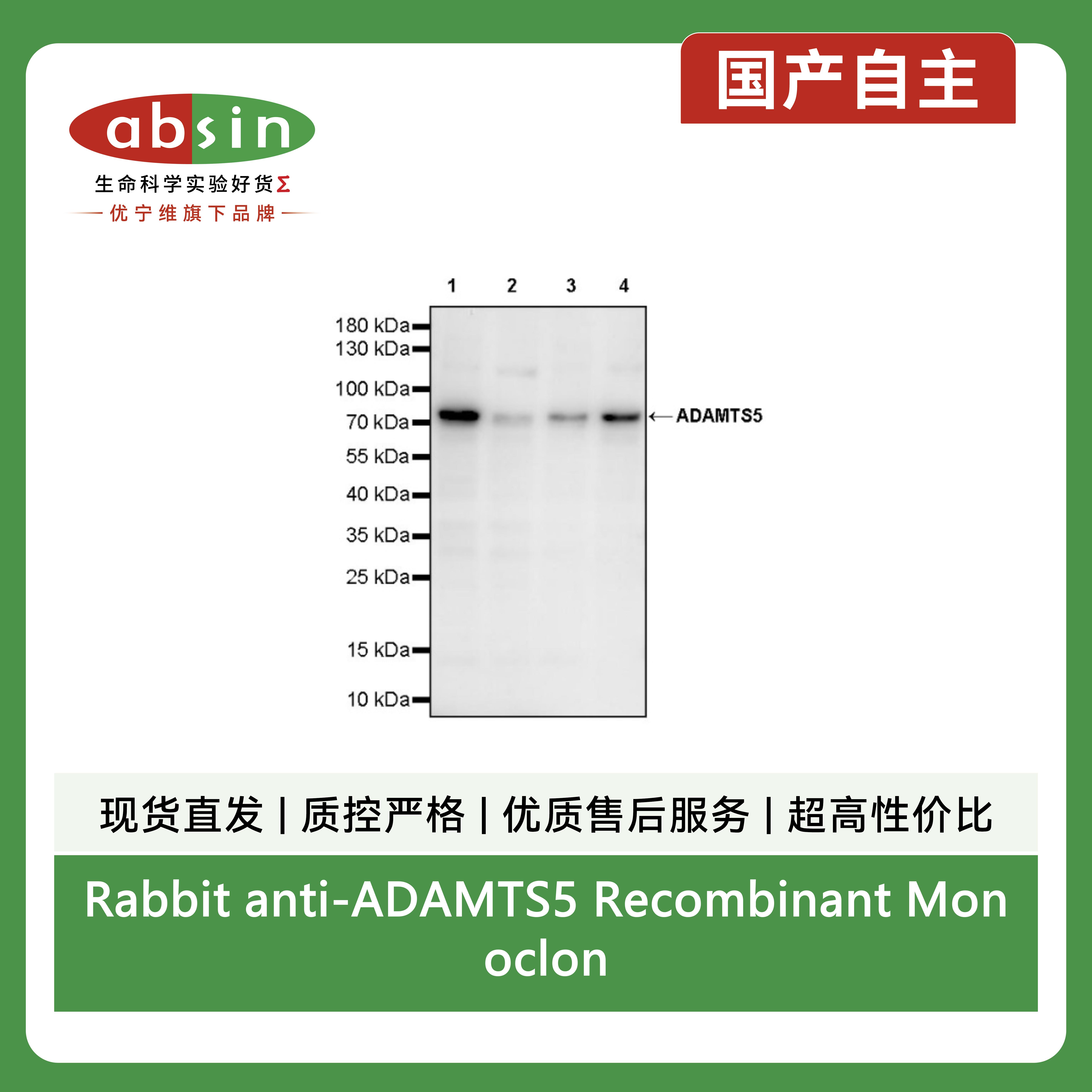 Rabbit anti-ADAMTS5 Recombinant Monoclonal Antibody(S-2315-138)产品图