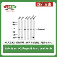 Rabbit anti-Collagen II Polyclonal Antibody