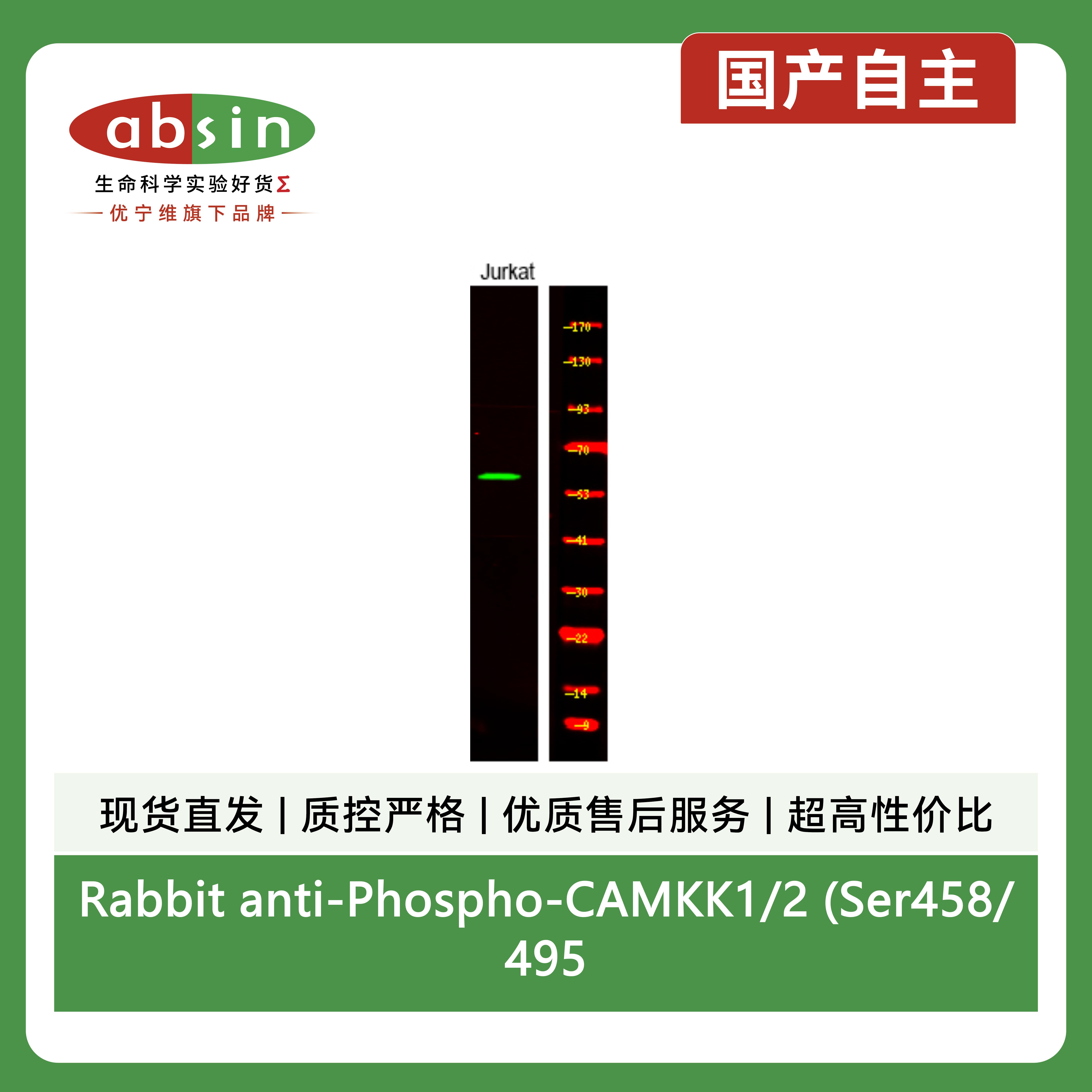 Rabbit anti-Phospho-CAMKK1/2 (Ser458/495)Polyclonal Antibody产品图