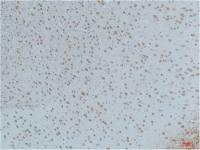 Mouse anti-Phospho-CaMKIIβ/γ/δ (Thr287) Monoclonal Antibody Antibody(4H2) Monoclonal Antibody