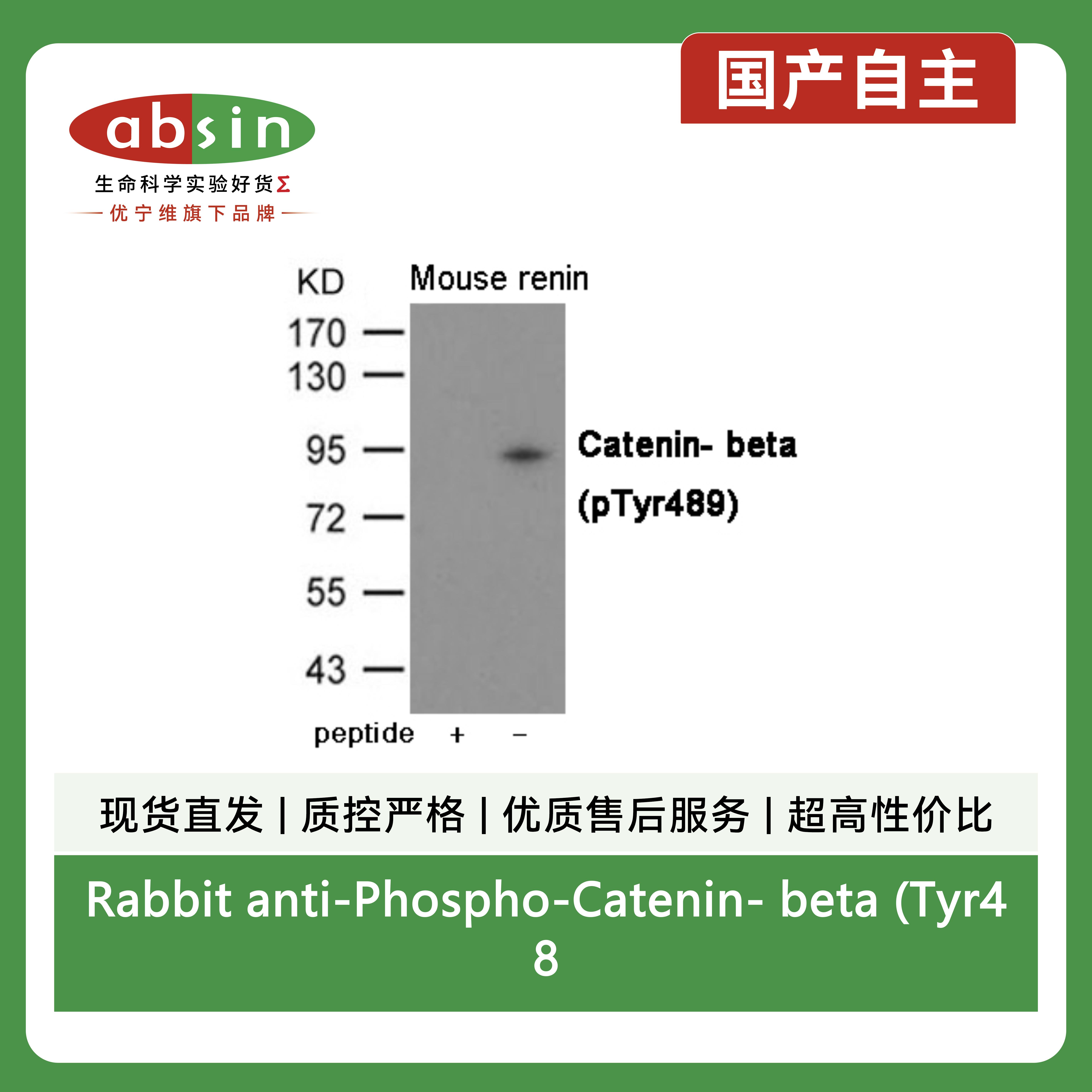 Rabbit anti-Phospho-Catenin- beta (Tyr489)Polyclonal Antibody产品图