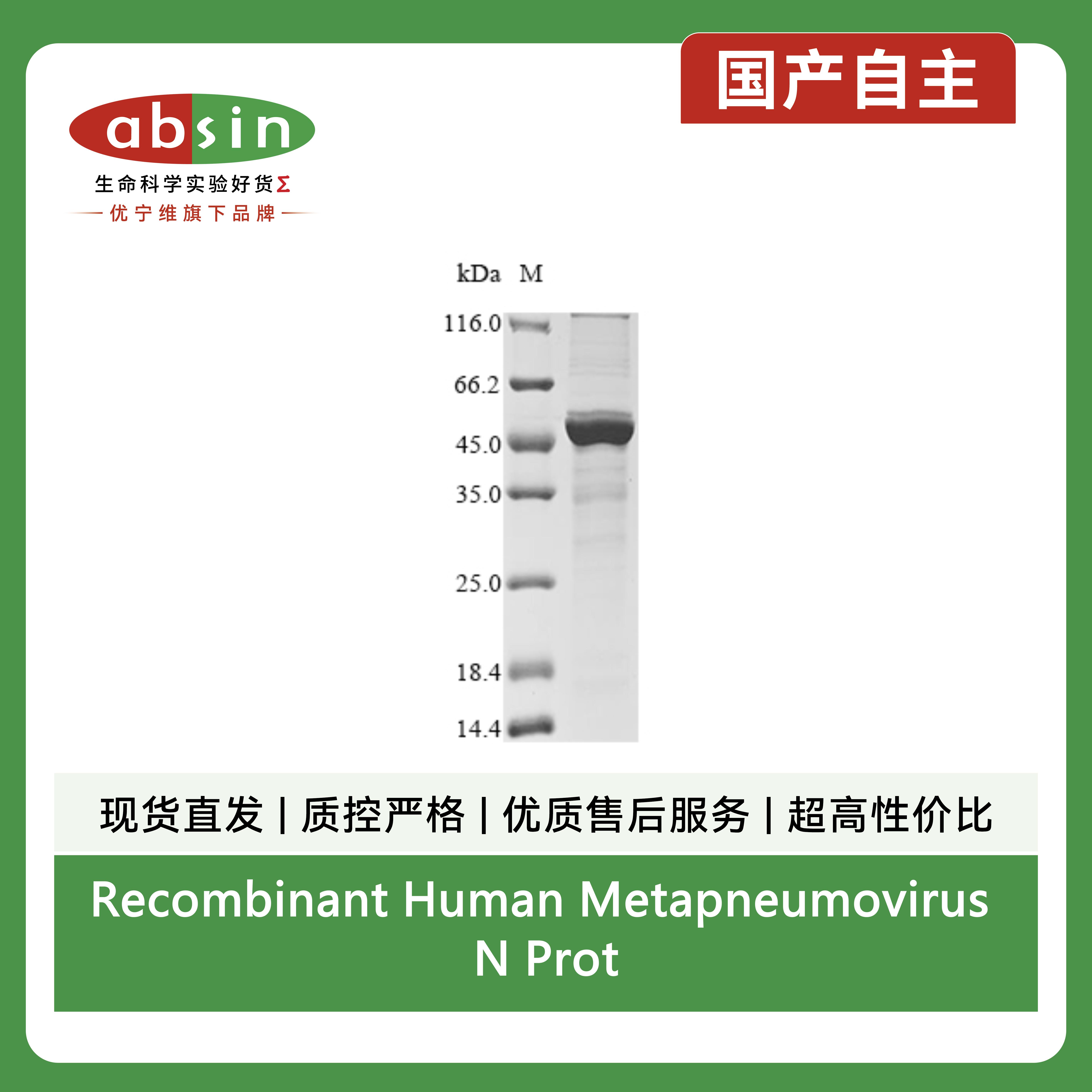 Recombinant Human Metapneumovirus N Protein (N-terminal 10xHis and C-terminal Myc)产品图
