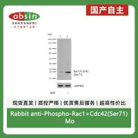 Rabbit anti-Phospho-Rac1+Cdc42(Ser71) Monoclonal Antibody