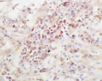 Rabbit anti-ADAMTS13 Polyclonal Antibody