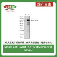 Mouse anti-SATB1+SATB2 Recombinant Monoclonal Antibody(S-3382)