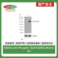 Rabbit anti-Phospho-GluR1(S845) Monoclonal Antibody