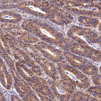 Rabbit anti-Argonaute 2 Recombinant Monoclonal Antibody(S-2620-13)