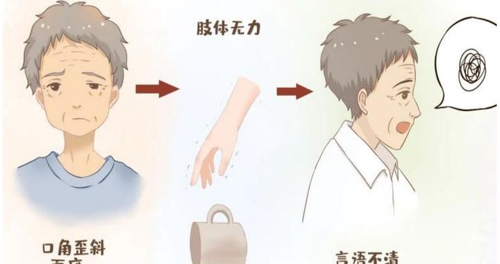 重症肌无力发病机制