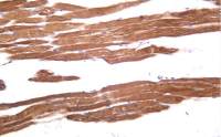 Rabbit anti-Phospho-Hormone sensitive lipase (S853) Monoclonal Antibody
