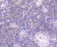Rabbit anti-Phospho-JunD(S255) Monoclonal Antibody