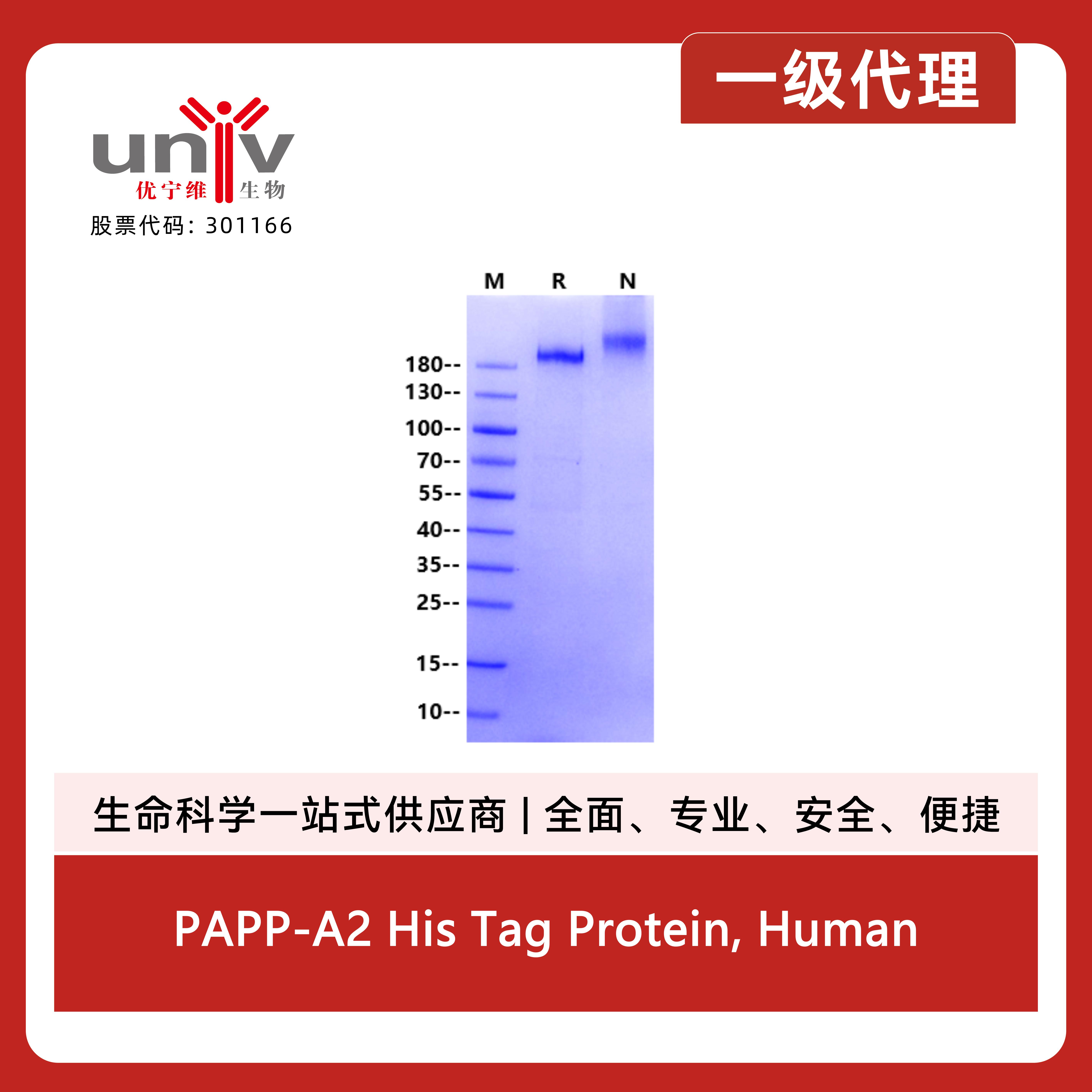 PAPP-A2 His Tag Protein, Human产品图
