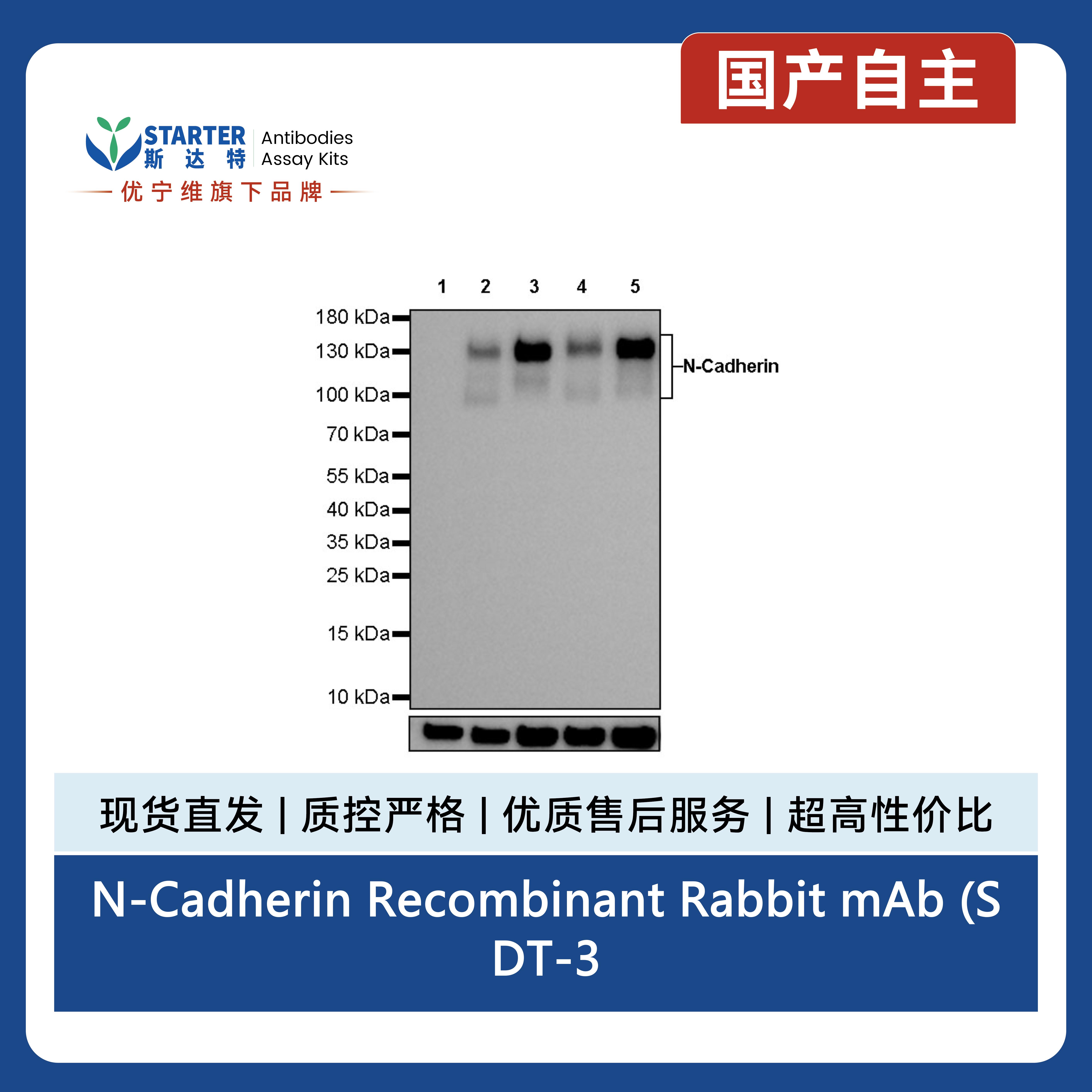 N-Cadherin Recombinant Rabbit mAb (SDT-329-12)产品图