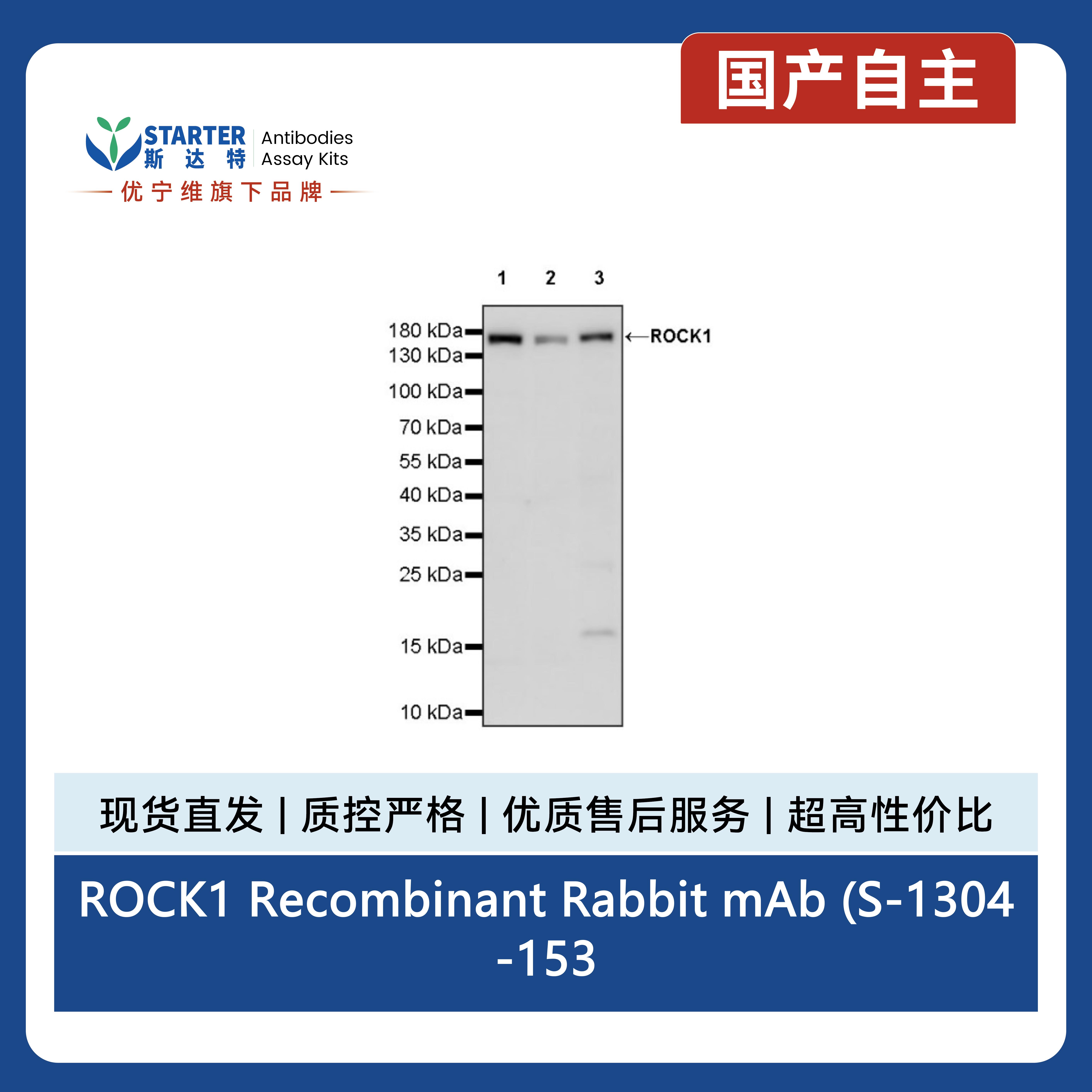 ROCK1 Recombinant Rabbit mAb (S-1304-153)产品图
