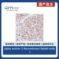 alpha-actinin-2 Recombinant Rabbit mAb (SDT-032-79)