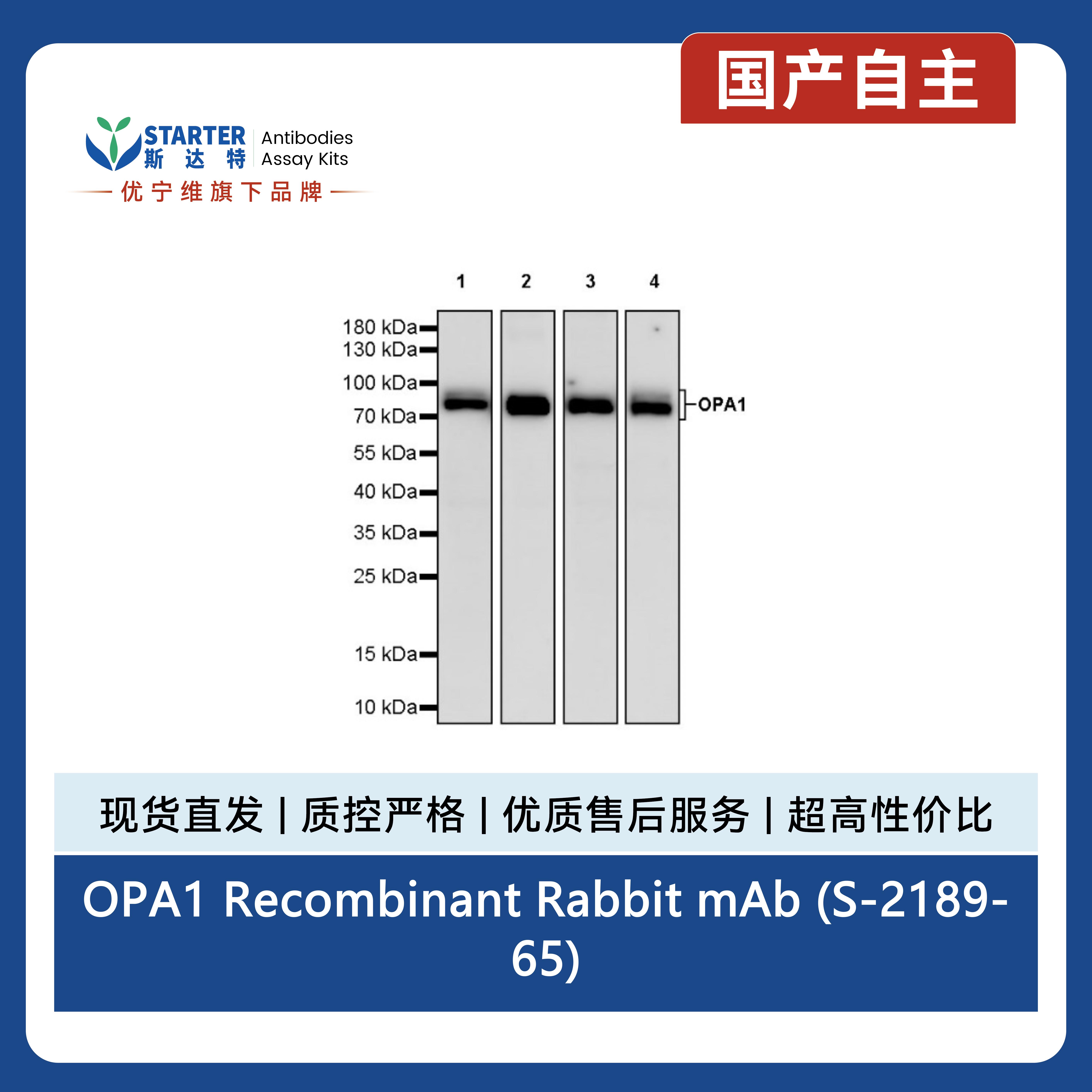 OPA1 Recombinant Rabbit mAb (S-2189-65)产品图