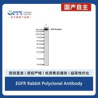 EGFR Rabbit Polyclonal Antibody