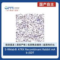 S-RMab® ATRX Recombinant Rabbit mAb (SDT-458-37)