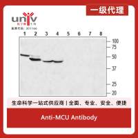 Anti-MCU Antibody