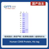 Human CDK8 Protein, His tag