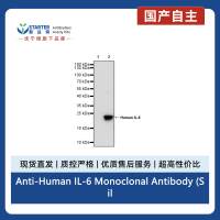 Anti-Human IL-6 Monoclonal Antibody (Siltuximab)