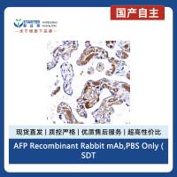 AFP Recombinant Rabbit mAb,PBS Only (SDT-R031)