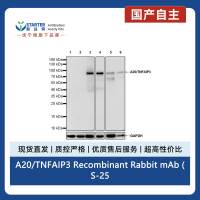 A20/TNFAIP3 Recombinant Rabbit mAb (S-2578-5)