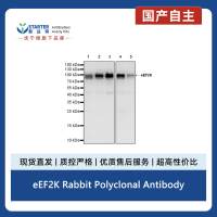 eEF2K Rabbit Polyclonal Antibody