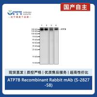 ATP7B Recombinant Rabbit mAb (S-2827-58)
