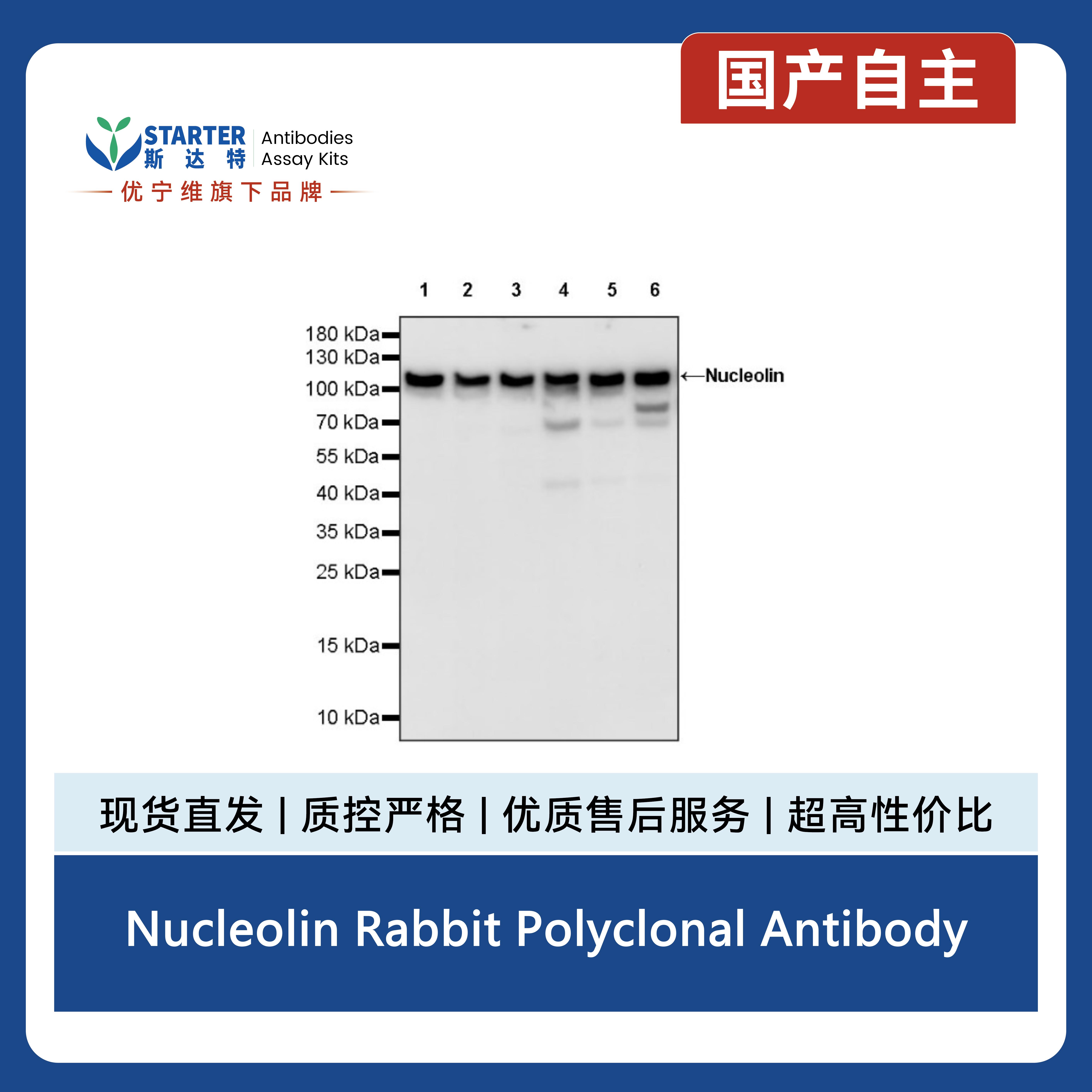 Nucleolin Rabbit Polyclonal Antibody产品图