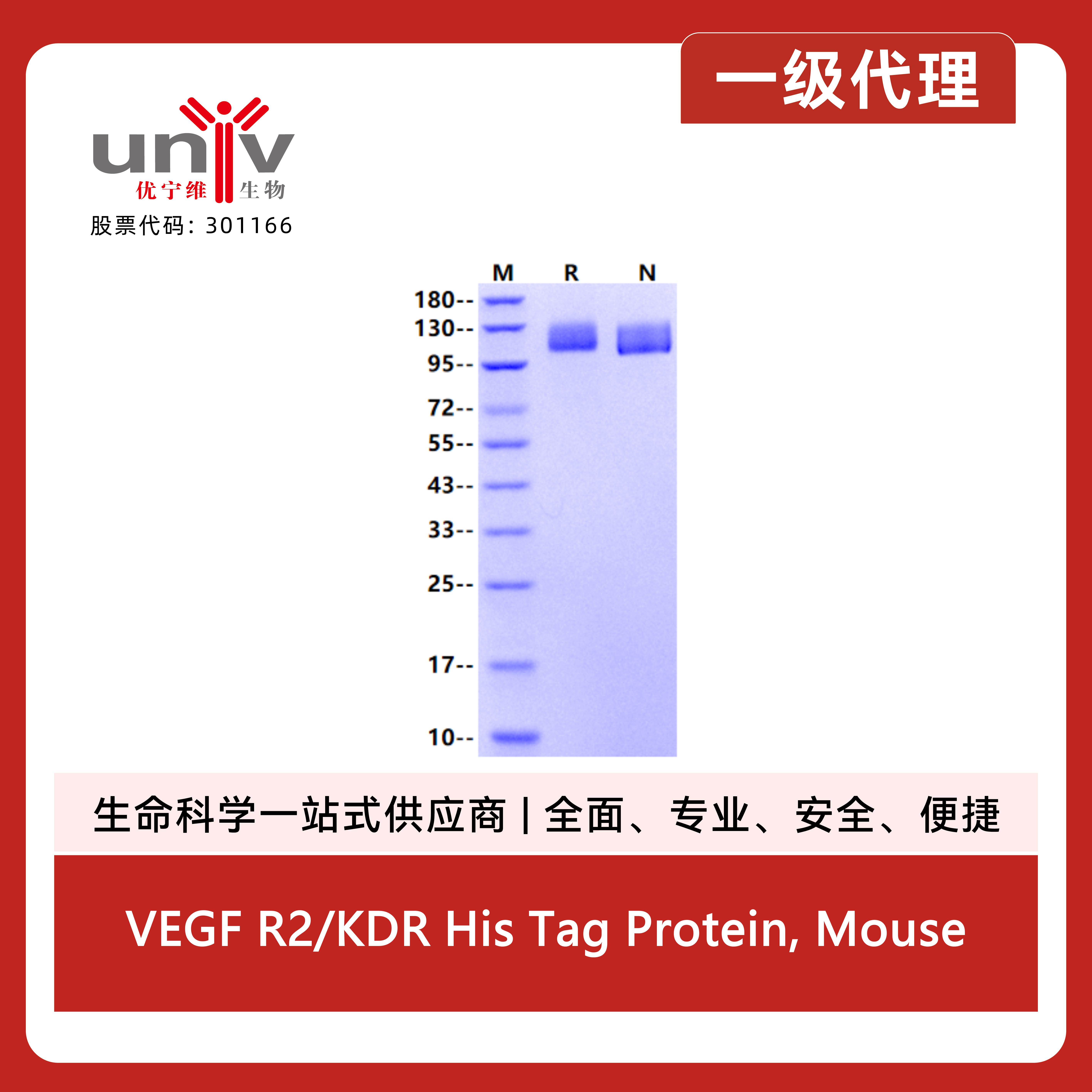 VEGF R2/KDR His Tag Protein, Mouse产品图
