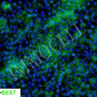 hPSC来源视网膜色素上皮细胞 iRPE(iPSC)