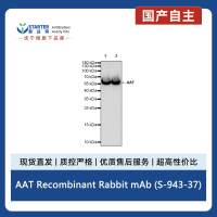 AAT Recombinant Rabbit mAb (S-943-37)