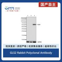 GLS2 Rabbit Polyclonal Antibody