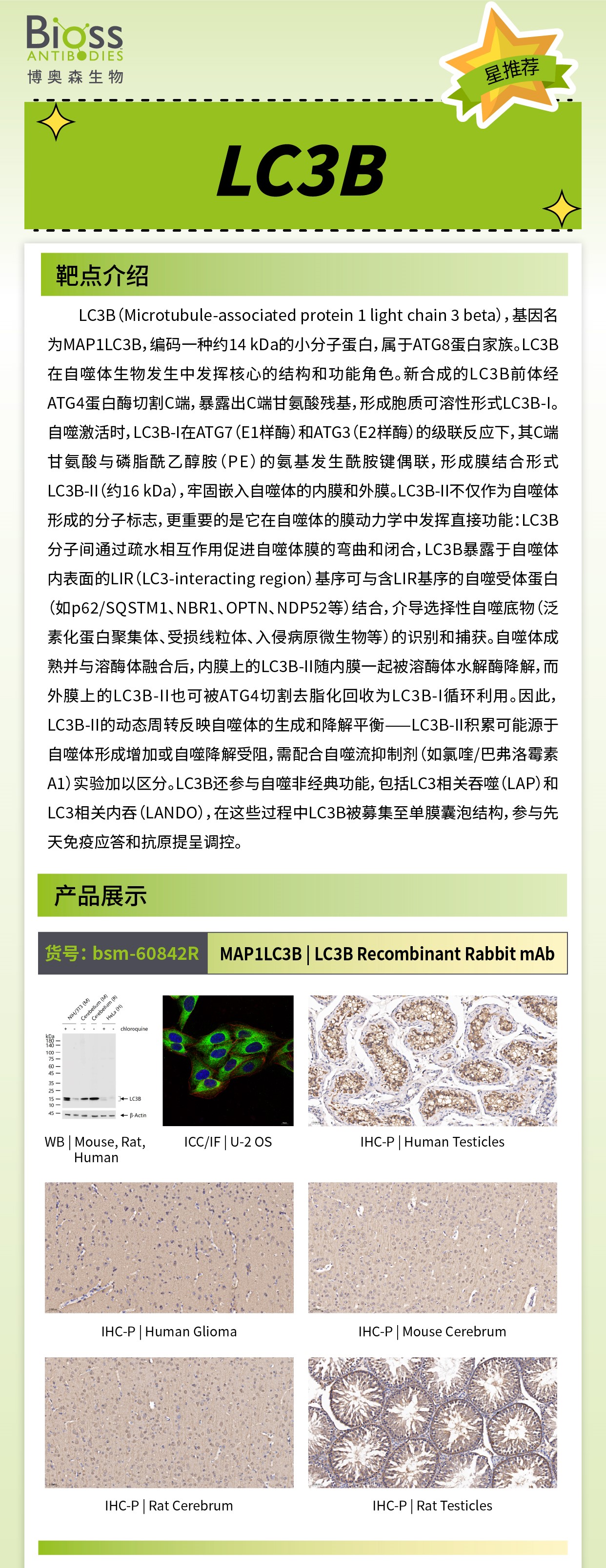 博奥森星推荐 | LC3B 抗体