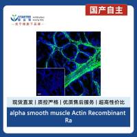 alpha smooth muscle Actin Recombinant Rabbit mAb (FITC Conjugate) (SDT-132-63)