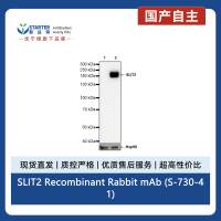 SLIT2 Recombinant Rabbit mAb (S-730-41)