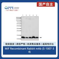 MIF Recombinant Rabbit mAb (S-1007-34)