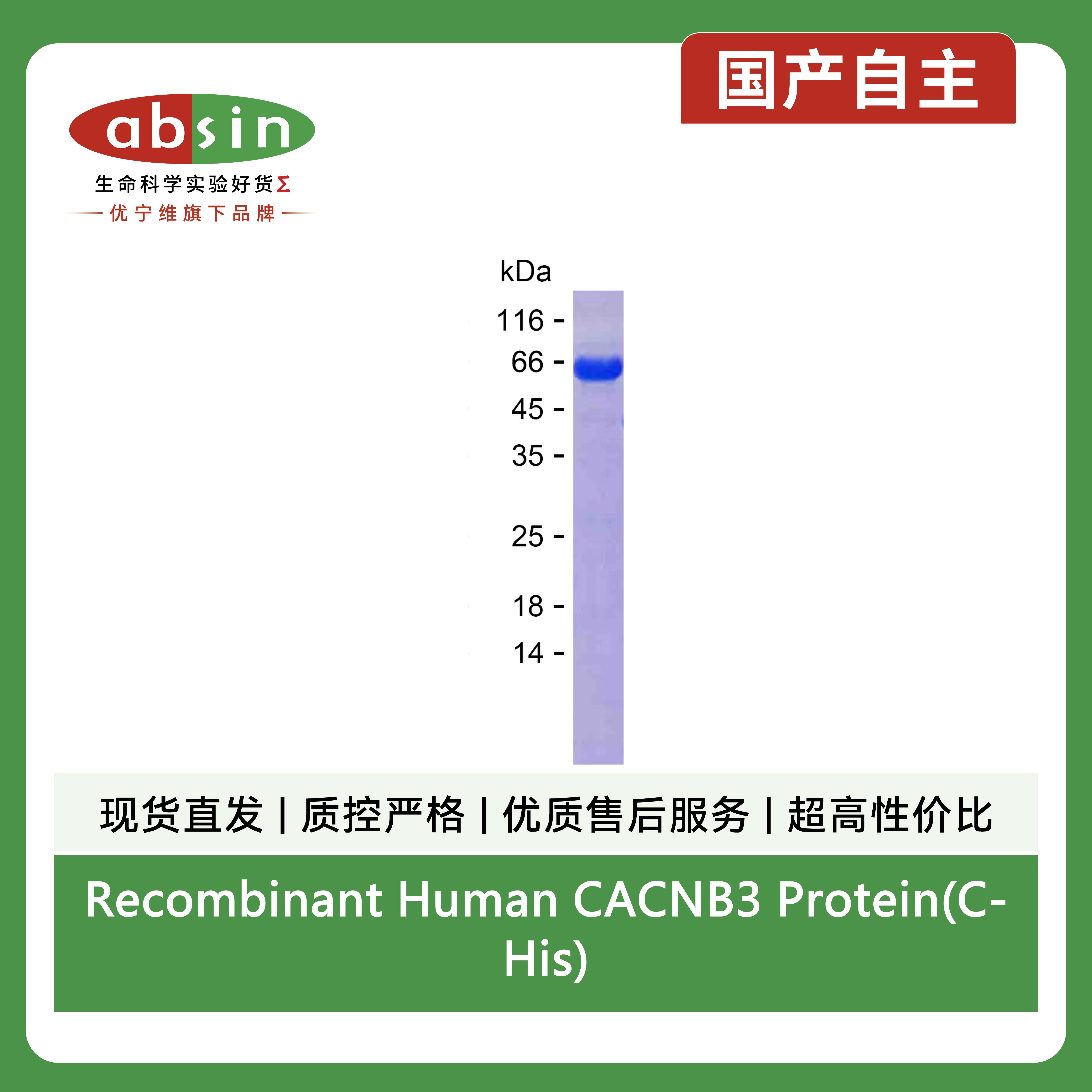 Recombinant Human CACNB3 Protein(C-His)产品图