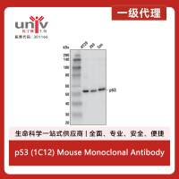 p53 (1C12) Mouse Monoclonal Antibody