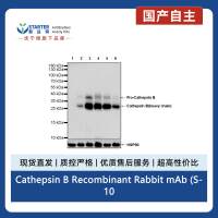 Cathepsin B Recombinant Rabbit mAb (S-1067-7)