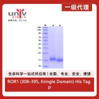 ROR1 (308-395, Kringle Domain) His Tag protein