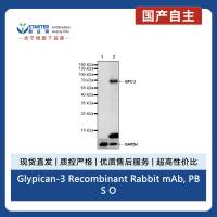 Glypican-3 Recombinant Rabbit mAb, PBS Only (SDT-4064-69-2)