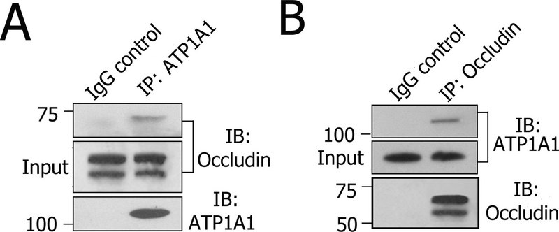 抗Na+/K+ ATPase α-1 抗体,克隆C464.6 clone C464.6, Upstate®, from mouse