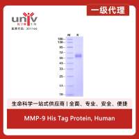 MMP-9 His Tag Protein, Human